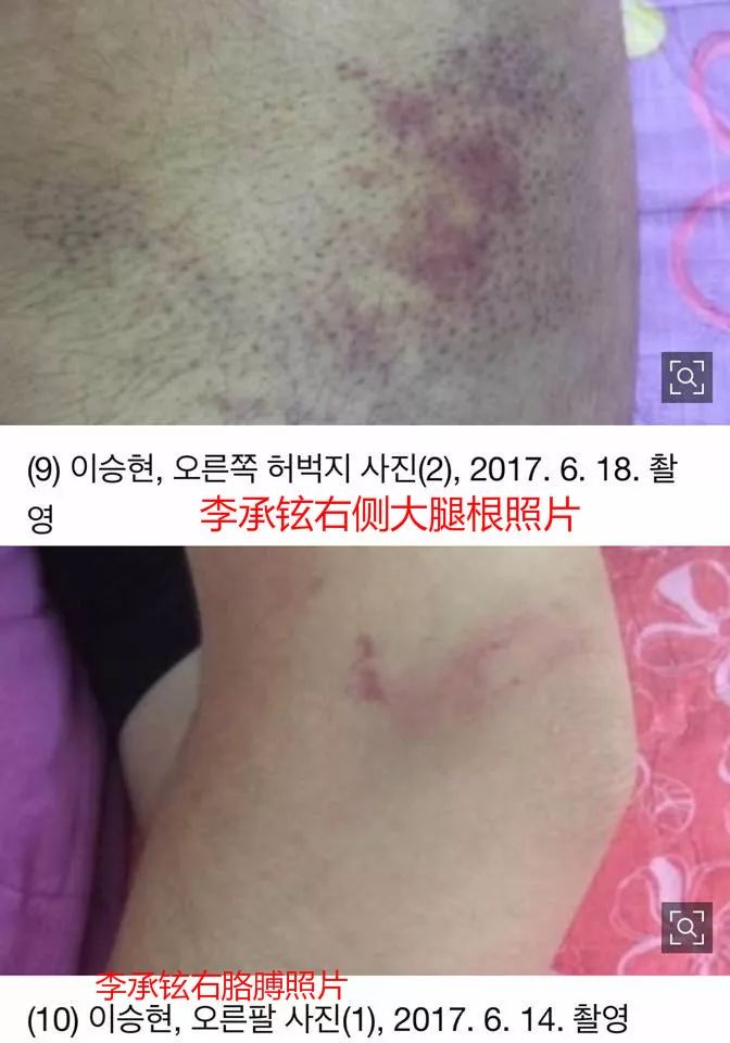 心疼!韩国未成年男团成员常年遭经纪公司暴打,怎么下得去如此狠手?